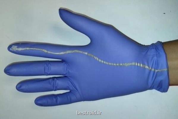 دستکش جراحی که از مرگ نوزادان جلوگیری می کند