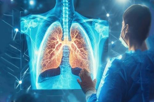 درمان صدمه های ریوی با ترکیب نانوذرات لیپیدی و mRNA