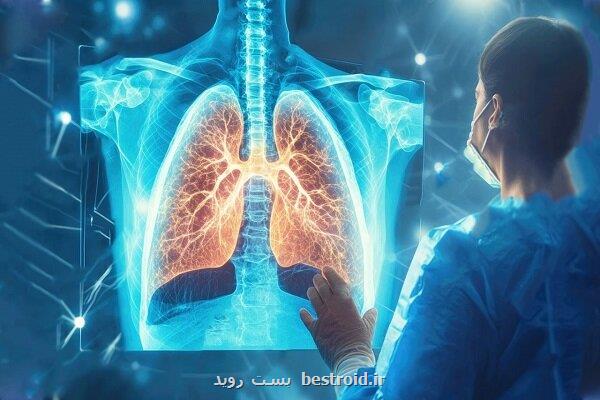 درمان صدمه های ریوی با ترکیب نانوذرات لیپیدی و mRNA