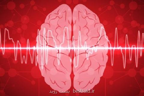 سیستم جدید هوش مصنوعی علائم مغزی را به سخنرانی مبدل می كند