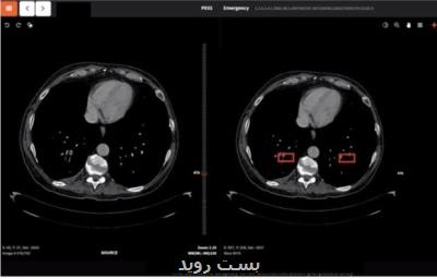 اقدامات مبتنی بر هوش مصنوعی پژوهشگران كشور برای مقابله با كرونا